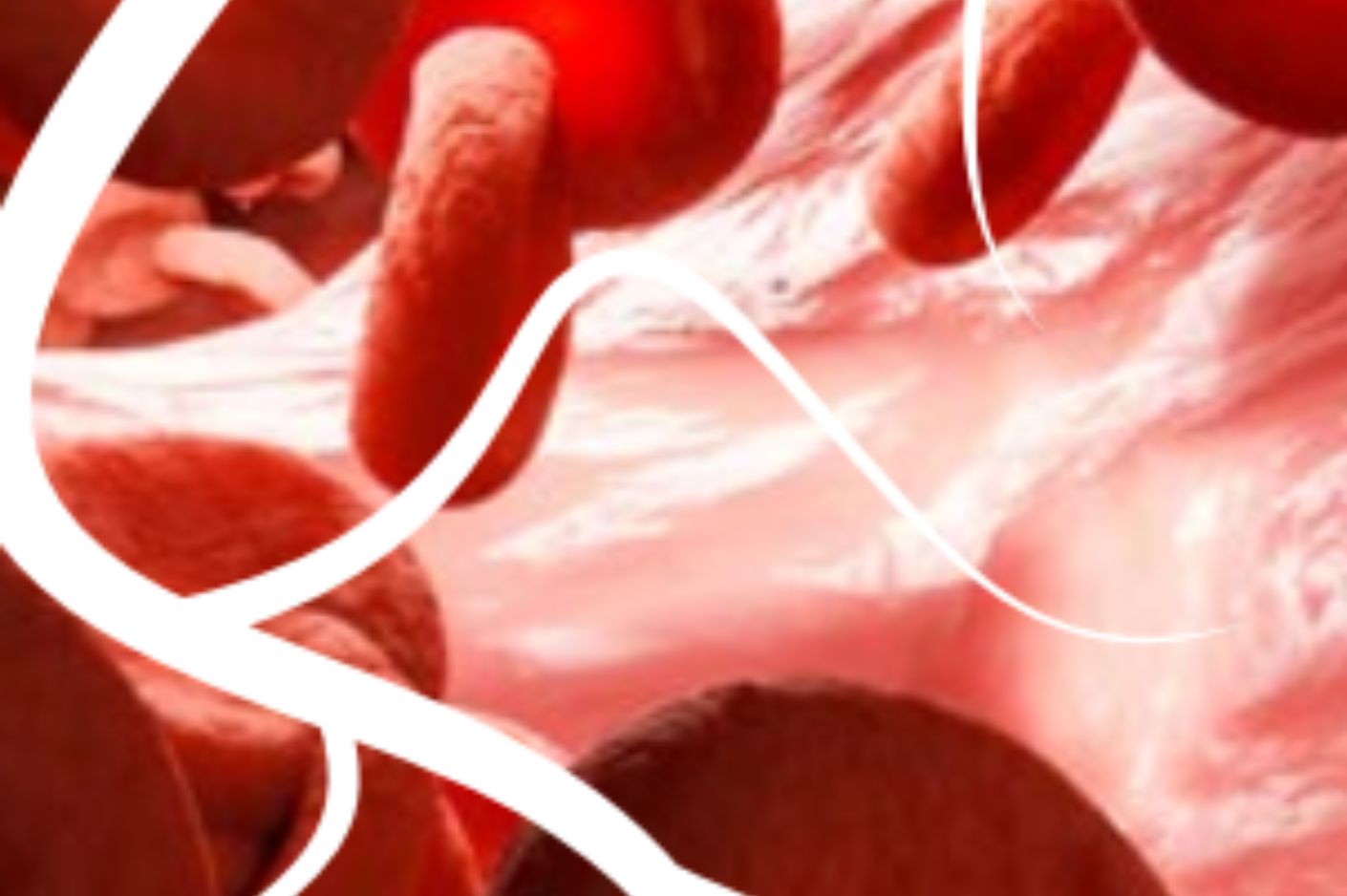 Clicca per accedere all'articolo APPROPRIATEZZA IN CHIRURGIA VASCOLARE TRA TERRITORIO E OSPEDALE FOCUS ON: ARTERIOPATIA PERIFERICA